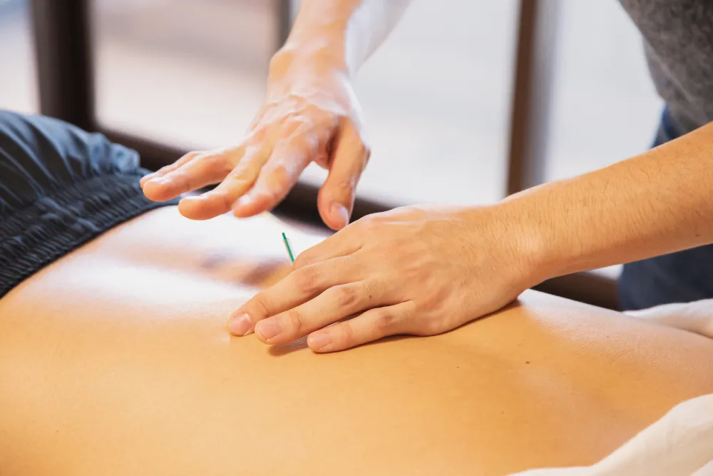 ims-acupuncture-physiotherapy